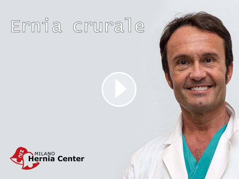 Prof. Campanelli - ernia crurale